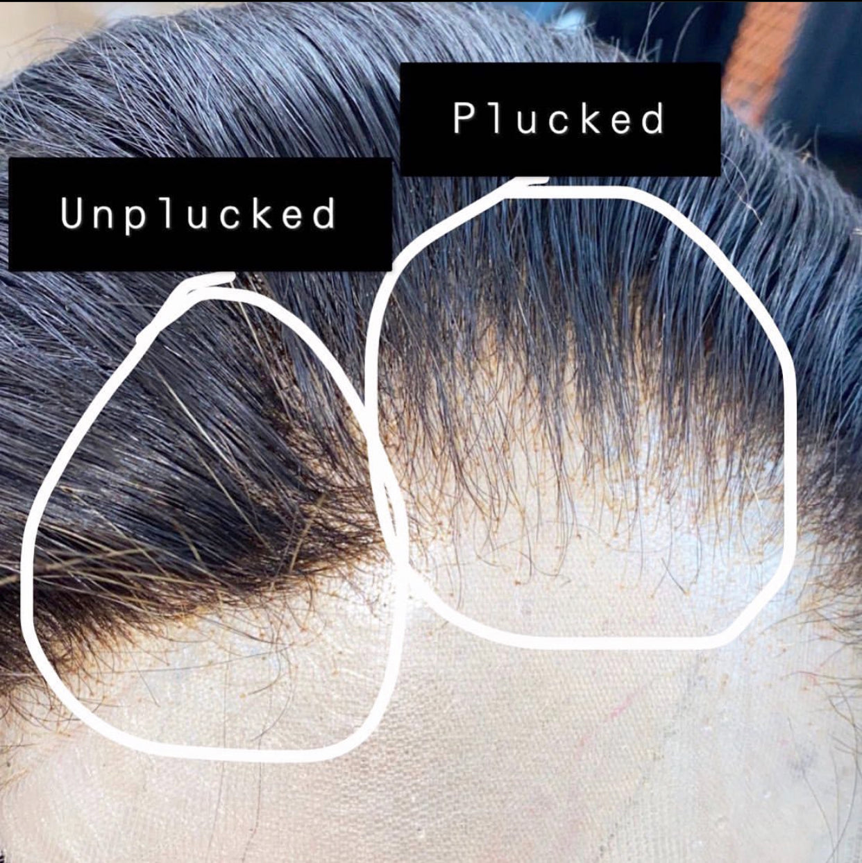 Closure customisation